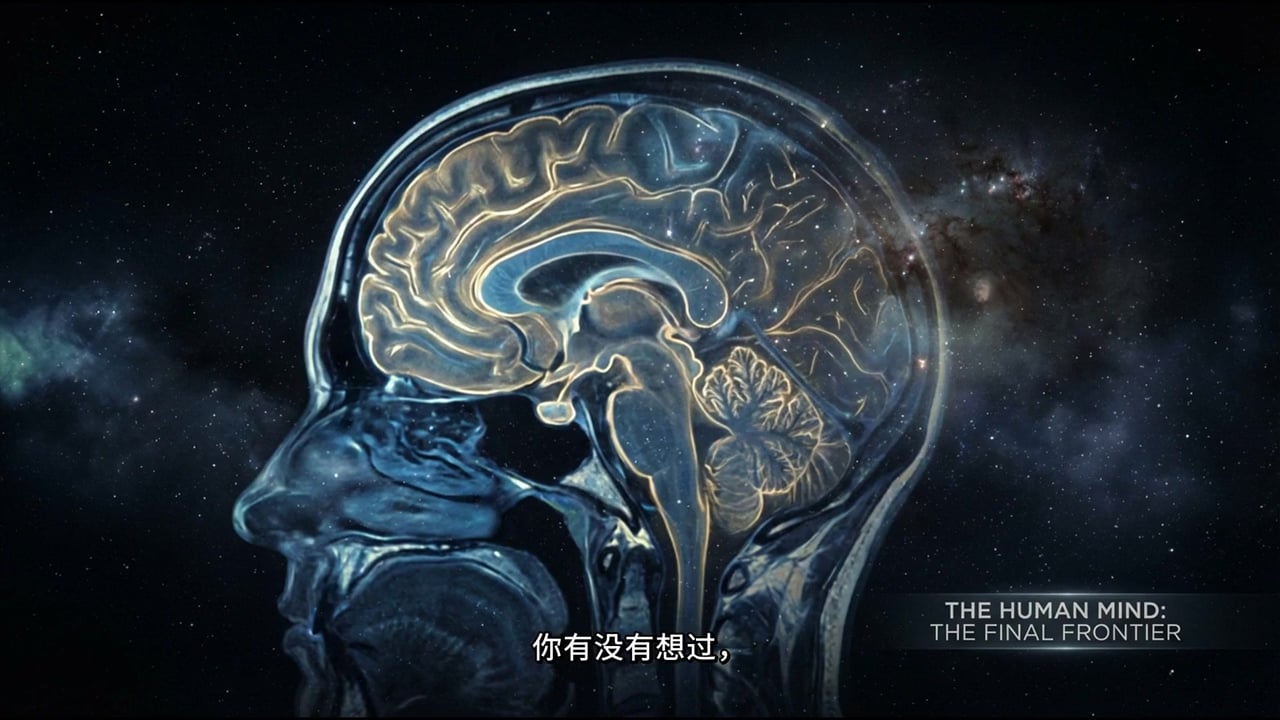 脑部PET扫描科普Slider视频v2